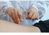 Acupuncture from YUMEI KIDNEY DISEASE HOSPITAL, BEIJING, CHINA